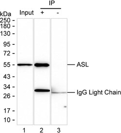 Invitrogen ASL Recombinant Mouse Monoclonal Antibody (KBL001_19F1) 100 &mu;L | Buy Online | Invitrogen&trade; | Fisher Scientific
