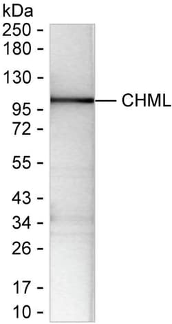 Invitrogen CHML Recombinant Mouse Monoclonal Antibody (K92072_16C11) 50 &mu;L | Buy Online | Invitrogen&trade; | Fisher Scientific