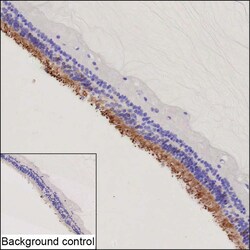 Invitrogen PDE6C Recombinant Mouse Monoclonal Antibody (K92073_15A1) 50 &mu;L | Buy Online | Invitrogen&trade; | Fisher Scientific
