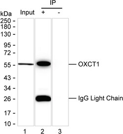 Invitrogen OXCT1 Recombinant Mouse Monoclonal Antibody (KBL001_10D10) 50 &mu;L | Buy Online | Invitrogen&trade; | Fisher Scientific