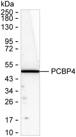 Invitrogen PCBP4 Recombinant Mouse Monoclonal Antibody (K1E075_14F9) 50 &mu;L | Buy Online | Invitrogen&trade; | Fisher Scientific