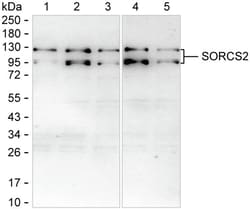 Invitrogen SorCS2 Recombinant Mouse Monoclonal Antibody (K1E068_6E10) 100 &mu;L | Buy Online | Invitrogen&trade; | Fisher Scientific