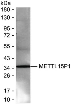 Invitrogen METTL15P1 Recombinant Mouse Monoclonal Antibody (K1H006_6E6) 50 &mu;L | Buy Online | Invitrogen&trade; | Fisher Scientific