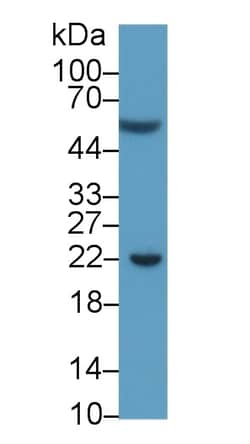 Invitrogen&trade;&nbsp;PD-L1 Monoclonal Antibody (C3)