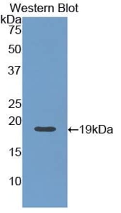 Invitrogen&trade;&nbsp;Angiopoietin 1 Monoclonal Antibody (9#)