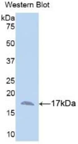 Invitrogen&trade;&nbsp;Annexin A3 Monoclonal Antibody (2#)