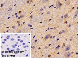 Invitrogen PYGL Monoclonal Antibody (9#) 200 &mu;L; Unconjugated:Antibodies,