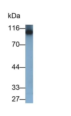 Invitrogen PYGL Monoclonal Antibody (9#) 200 &mu;L; Unconjugated:Antibodies,