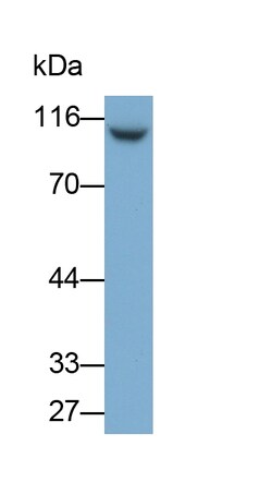Invitrogen PYGL Monoclonal Antibody (9#) 200 &mu;L; Unconjugated:Antibodies,
