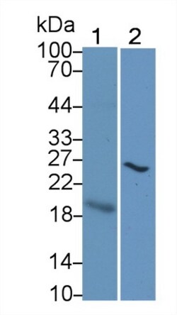 Invitrogen&trade;&nbsp;CTLA-4 Monoclonal Antibody (D4)