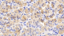 Invitrogen mTOR Monoclonal Antibody (D7) 200 &mu;L; Unconjugated:Antibodies,