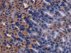 Invitrogen&trade;&nbsp;Somatostatin Monoclonal Antibody (C11)
