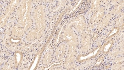 Invitrogen&trade;&nbsp;Tenascin C Monoclonal Antibody (C4)