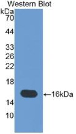 Invitrogen&trade;&nbsp;Tenascin C Monoclonal Antibody (C4)