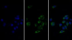 Invitrogen&trade;&nbsp;FABP3 Monoclonal Antibody (C5)