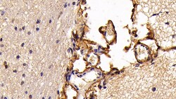 Invitrogen S100A10 Monoclonal Antibody (C3) 200 &mu;L; Unconjugated:Antibodies,