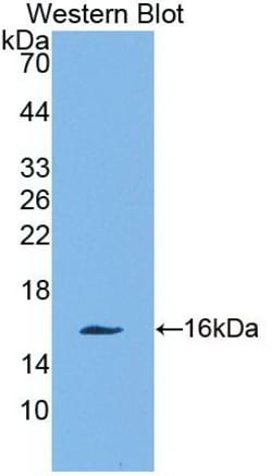 Invitrogen&trade;&nbsp;Galectin 10 Monoclonal Antibody (C2)