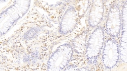 Invitrogen™ CD177 Monoclonal Antibody (C11)