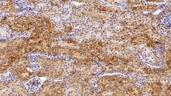 Invitrogen&trade;&nbsp;FGF1 Monoclonal Antibody (C14)