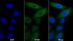 Invitrogen MMP13 Monoclonal Antibody (D13) 200 &mu;L; Unconjugated:Antibodies,