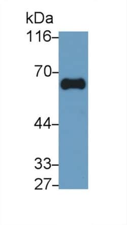 Invitrogen&trade;&nbsp;GGT1 Monoclonal Antibody (C1)