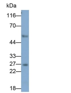 Invitrogen™ Granzyme K Monoclonal Antibody (C3)