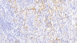 Invitrogen&trade;&nbsp;Ferritin Light Chain Monoclonal Antibody (H1)