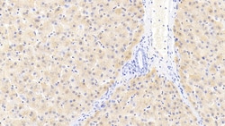 Invitrogen&trade;&nbsp;Ferritin Light Chain Monoclonal Antibody (H1)