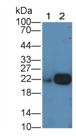 Invitrogen&trade;&nbsp;Ferritin Light Chain Monoclonal Antibody (H1)