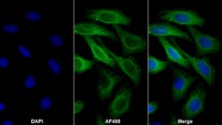Invitrogen beta Tubulin Monoclonal Antibody (C4-2) 200 &mu;L; Unconjugated:Antibodies,