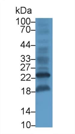 Invitrogen&trade;&nbsp;HBEGF Monoclonal Antibody (D2)