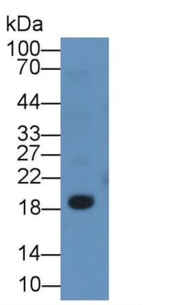Invitrogen&trade;&nbsp;CD3d Monoclonal Antibody (C6)