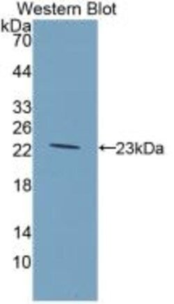 Invitrogen GCKR Monoclonal Antibody (4#) 200 &mu;L; Unconjugated:Antibodies,