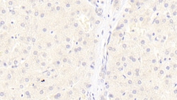 Invitrogen&trade;&nbsp;LRP6 Monoclonal Antibody (C3)