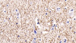 Invitrogen BAI3 Monoclonal Antibody (C6) 200 &mu;L; Unconjugated:Antibodies,
