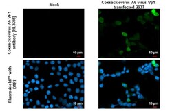 Invitrogen Coxsackievirus A6 VP1 Recombinant Rabbit Monoclonal Antibody