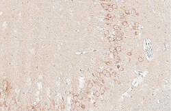 Invitrogen ZPK Recombinant Rabbit Monoclonal Antibody (HL3423) 100 &mu;L;