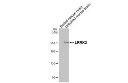 Invitrogen&trade;&nbsp;LRRK2 Recombinant Rabbit Monoclonal Antibody (HL3167)