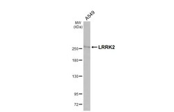 Invitrogen LRRK2 Recombinant Rabbit Monoclonal Antibody (HL3167) 100 &mu;L;