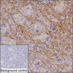 Invitrogen&trade;&nbsp;ROR2 Recombinant Rabbit Monoclonal Antibody (K01_2Y99)