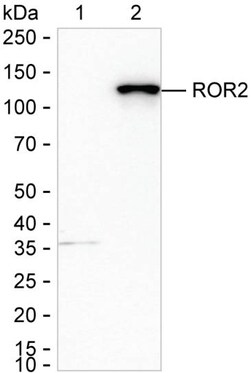 Invitrogen ROR2 Recombinant Rabbit Monoclonal Antibody (K01_2Y99) 100 &mu;L | Buy Online | Invitrogen&trade; | Fisher Scientific