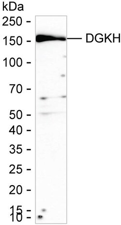 Invitrogen DGKH Recombinant Mouse Monoclonal Antibody (K94091_8F5) 100 &mu;L | Buy Online | Invitrogen&trade; | Fisher Scientific