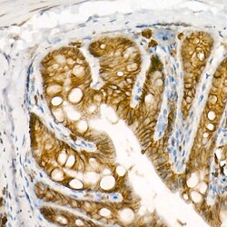 Invitrogen Protein APC Recombinant Rabbit Monoclonal Antibody (0V2X6) 20 &mu;L | Buy Online | Invitrogen&trade; | Fisher Scientific