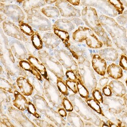 Invitrogen Protein APC Recombinant Rabbit Monoclonal Antibody (0V2X6) 20 &mu;L | Buy Online | Invitrogen&trade; | Fisher Scientific