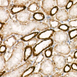 Invitrogen Protein APC Recombinant Rabbit Monoclonal Antibody (0V2X6) 20 &mu;L | Buy Online | Invitrogen&trade; | Fisher Scientific