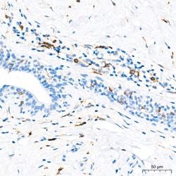 Invitrogen&trade;&nbsp;FCGRT Recombinant Rabbit Monoclonal Antibody (8R2Z10)