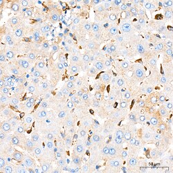 Invitrogen FCGRT Recombinant Rabbit Monoclonal Antibody (8R2Z10) 100 &mu;L | Buy Online | Invitrogen&trade; | Fisher Scientific