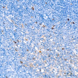 Invitrogen FCGRT Recombinant Rabbit Monoclonal Antibody (8R2Z10) 100 &mu;L | Buy Online | Invitrogen&trade; | Fisher Scientific
