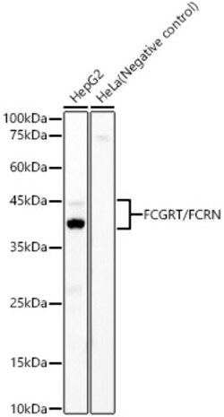 Invitrogen FCGRT Recombinant Rabbit Monoclonal Antibody (8R2Z10) 100 &mu;L | Buy Online | Invitrogen&trade; | Fisher Scientific