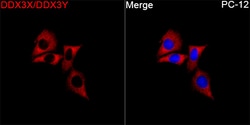 Invitrogen&trade;&nbsp;DDX3/DDX3Y Recombinant Rabbit Monoclonal Antibody (1N2I8)